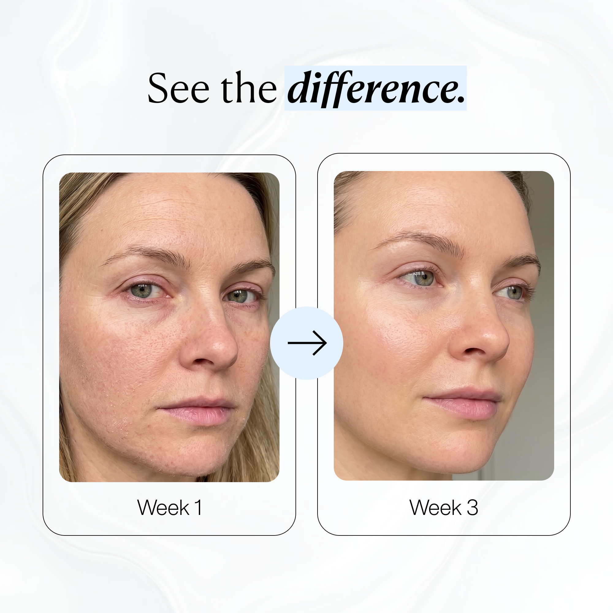 Collagen Mask