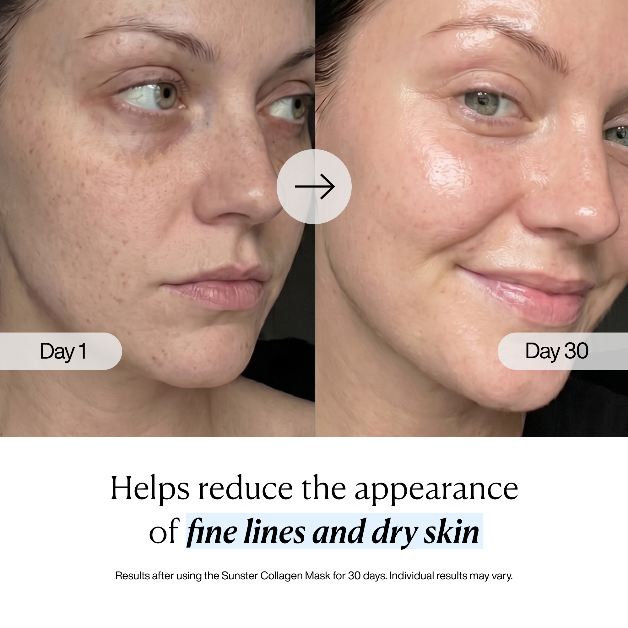 Collagen Mask